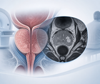 prostate mri screening standards and test performance