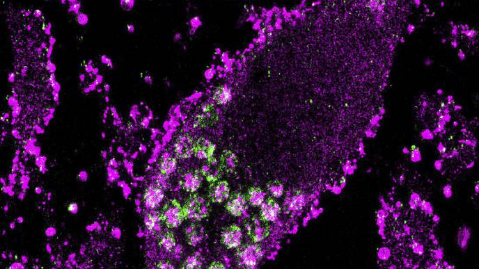 Full-Genome CRISPR Screen Reveals Surprising Ways Neurons Survive Oxidative Stress