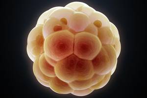 Use of HPV Genotyping for Triage in a 36-Year-Old Woman