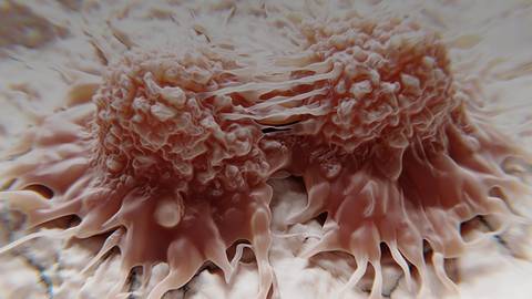 Where Do ADCs Fit in the Current Urothelial Cancer Treatment Paradigm?