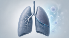 postoperative nivolumab does not improve dfs in resected nsclc