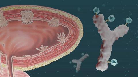 Antibody-Drug Conjugates: A New Option for Patients With Metastatic Urothelial Carcinoma
