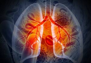 What Clinical Management Strategies Must Be Deployed to Effectively Transition From the Acute to Post-Acute Setting When a Pediatric VTE Patient Is at Risk for a Recurrent VTE?