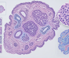 artificial intelligence in histopathology and cytopathology