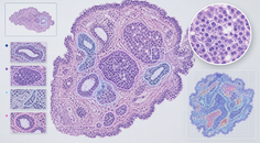 artificial intelligence in histopathology and cytopathology