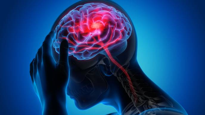 COVID-19 May Be Linked to Brain Complications, But Does It Cause Them?