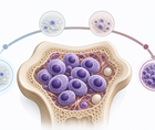 Simplified bone marrow plasma cell cluster illustrating multiple myeloma relapse timing