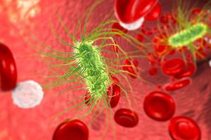 Use of HPV Genotyping for Triage in a 36-Year-Old Woman