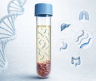 real world use of a 1021 gene liquid biopsy assay