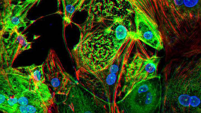 COVID-19 Can Kill Heart Muscle Cells, Interfere with Contraction