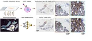Hepatocellular Carcinoma: Evaluating the Evolving Treatment Landscape