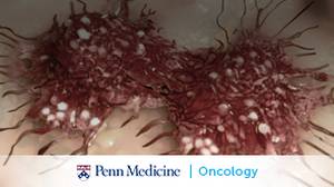 A Look at the Therapeutic Landscape for Metastatic Breast Cancer