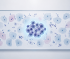 deep learning assistance vs manual reading in cervical cytopathology