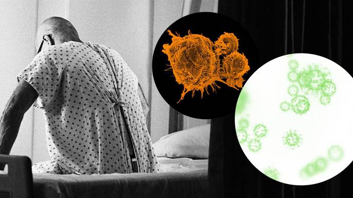 Op-Ed: COVID-19's Impact on Cancer Care Is Turning Oncologists' Worst Fears into Reality