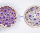 talquetamab and daratumumab in relapsed or refractory myeloma