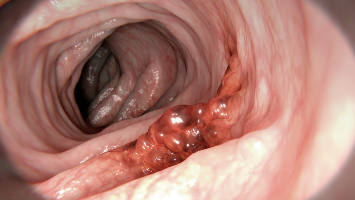 ReachMD Healthcare Image