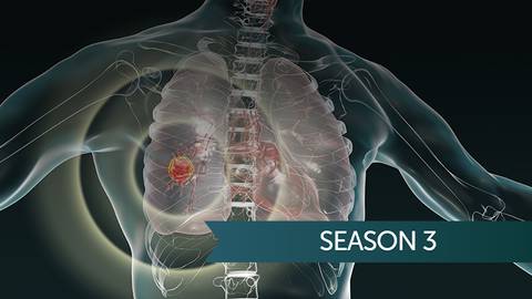 Current & Future Innovations in Lung Cancer Detection