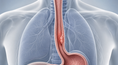 robot assisted versus conventional minimally invasive oesophagectomy