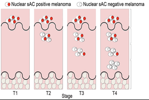 Keys to Managing Myelosuppressive Events in SCLC: A Review of the NCCN Guidelines