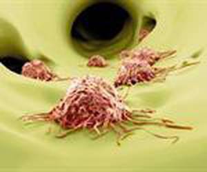 A Look at the Emerging Field of Oncofertility
