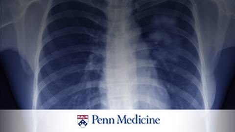 A Thoracic Surgeon's Viewpoint on Screening, Diagnosis and Treatment  of a Lung Cancer Patient