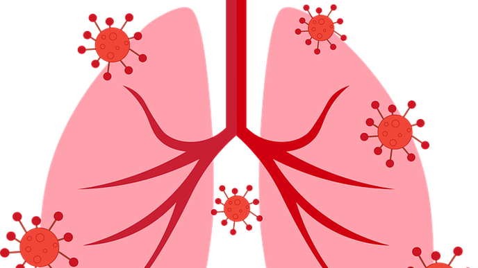 AI System Bests Radiologists in Spotting COVID-19 in Lungs