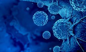 Pancreatic Cancer: Associated Signs, Symptoms, Risk Factors and Treatment Approaches