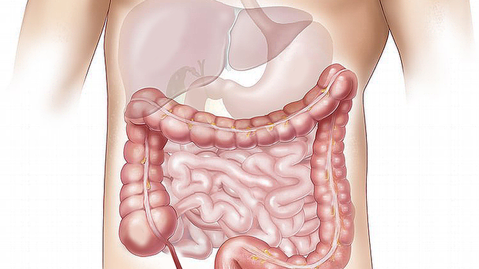Janssen Presents Results of First Head-to-Head Study of Biologic Therapies in Patients with Moderate to Severe Crohn's Disease