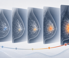 longitudinal mammographic deep learning risk scores track future cancer