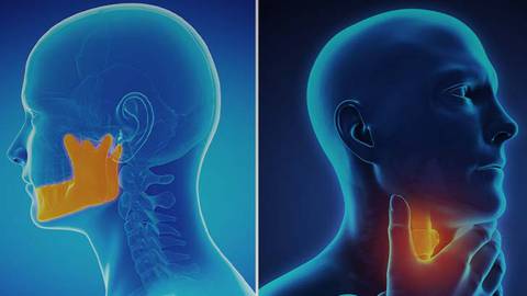 頭頸部がんに対する国際共同治験の解明 ：毒性を管理しつつ転帰を改善するアプローチの確認