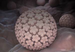 Use of HPV Genotyping for Triage in a 36-Year-Old Woman