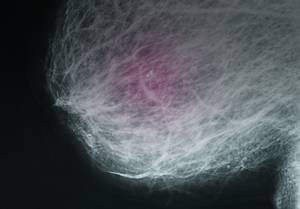 Breast Basics 101: What Every Woman Should Know About Breast Cancer Risk, Screening, & Detection