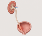 robotic versus laparoscopic radical nephroureterectomy in utuc t3 ivr signal