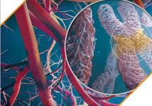 Evolving Perspectives in PIK3CA-related Overgrowth Spectrum Diagnosis & Treatment - Transcript