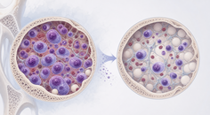 talquetamab and daratumumab in relapsed or refractory myeloma