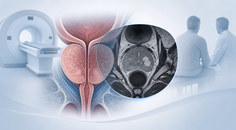 prostate mri screening standards and test performance