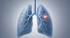 real world first line alk tki comparisons in alk positive nsclc