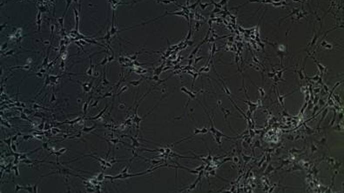 Study Identifies Group of Genes with Altered Expression in Autism