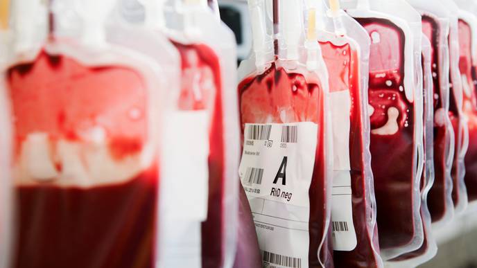 Blood Types May Play Role In COVID-19 Severity