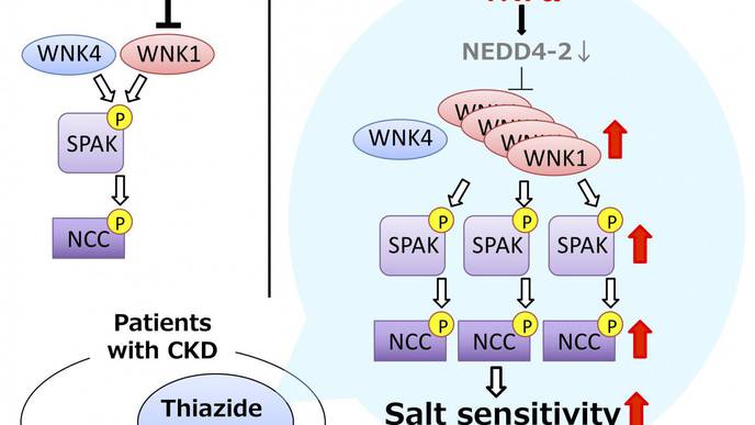 Researchers Link Immune System to Salt-sensitive Hypertension in CKD